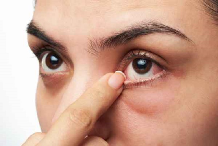 โรคในดวงตาที่ต้องระวัง เพื่อสุขภาพการมองเห็นที่ดี